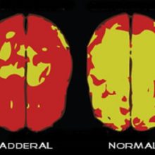Got ADHD or Symptoms of Depression? Try These Natural, Non-Habit Forming Alternatives to Adderall