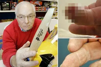 dr. oz series man regrows finger tip