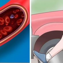 Ten Ways to Increase Circulation and Prevent Blood Clots