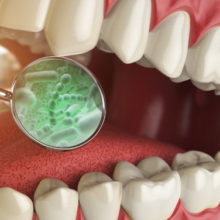 How to Improve the Health of Your Teeth and Gums By Swishing Saliva Around in Your Mouth