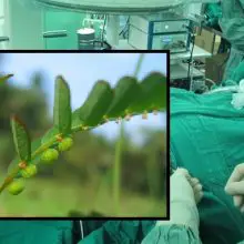 How to Prevent Kidney Stone Surgery with One Tropical Herb (Nicknamed “Stone Breaker” in Spanish)