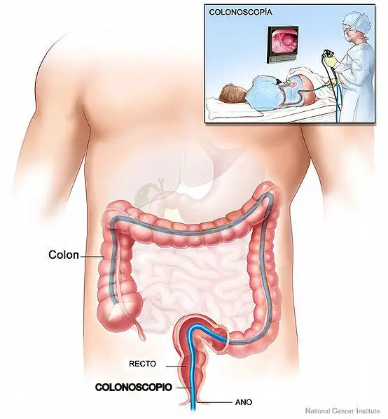 Are colon cleansings really worth it or are they worthless like mainstream doctors often say? Read on. 