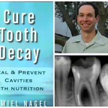 Feature Interview: ‘Cure Tooth Decay’ Author Ramiel Nagel on Healing Cavities Naturally, The Problem with Modern Dentistry and More