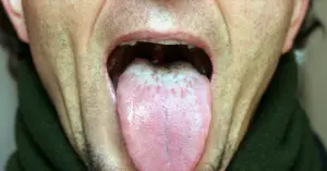 natural bad breath