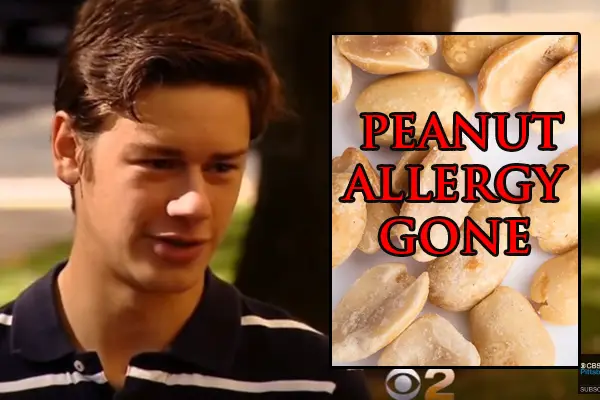 peanut-allergy-gone