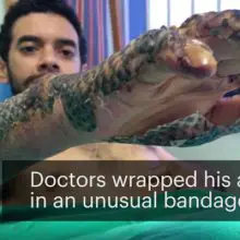 Brazilian Doctors Put This Type of “Unhealthy” Fish On Their Patients’ Skin – What Happened Next Will Shock You!