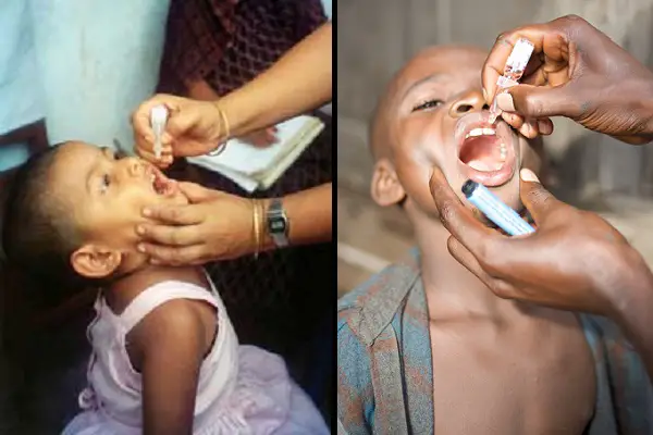 live polio vaccine