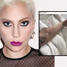Why Lady Gaga Developed Fibromyalgia (According to a Doctor) — And What We Can All Learn from Her Mistakes
