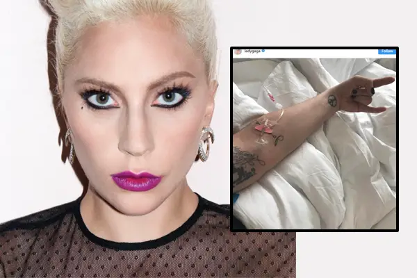 Lady Gaga Fibromaylgia 