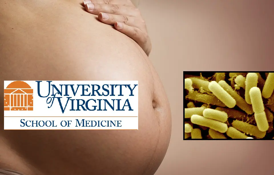 pregnancy autism supplements