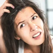 Five At-Home Remedies for Dandruff and Itchy, Flaky Skin You May Not Have Thought Of Before